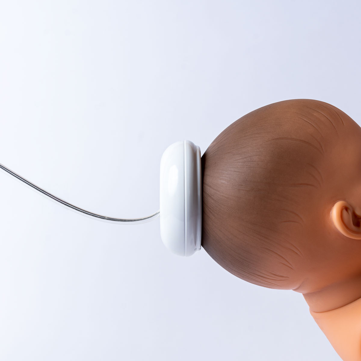 Szülészeti vákuum csésze elhelyezése - alacsony profil és rugalmas tömlő